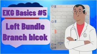 ECG basics  left bundle branch block LBBB  ECG findings and examples clinical importance [upl. by Ajim560]