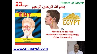 Larynx 3 Mosaad AbdelAziz Tumors of Larynx [upl. by Robbi]