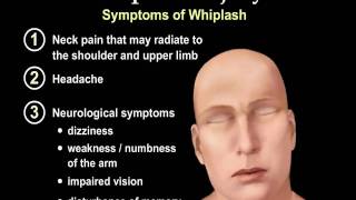 Whiplash Injury Animation  Everything You Need to Know  Dr Nabil Ebraheim MD [upl. by Tana653]