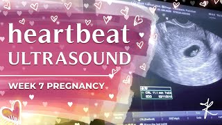 heartbeat ultrasound  week 7 pregnancy [upl. by Oiram]