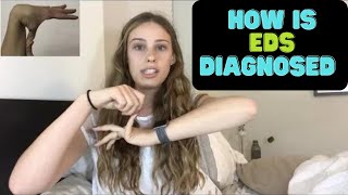 Hypermobile EDS Diagnostic Criteria 2017 [upl. by Joe]