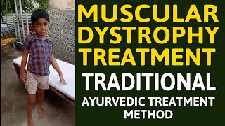 muscular dystrophy treatment in india  myopathy treatment in india [upl. by Wallinga]