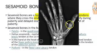 Anatomy 201 Sesamoid Bone Patella Pisiform Carpal bones Define Solved Question Paper [upl. by Hux]