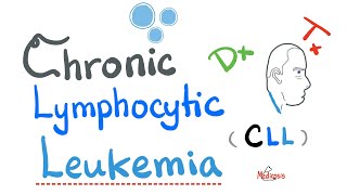 Chronic Lymphocytic Leukemia CLL  Diagnosis and Treatment Hematology and Oncology Series [upl. by Enutrof563]