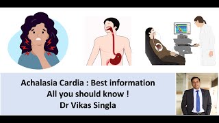 Achalasia cardia  Symptoms causes diagnosis treatment in Hindi Dr Vikas Sing [upl. by Tihor327]