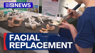 3D printing technology transform lives of head and neck cancer patients  9 News Australia [upl. by Tull]