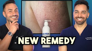 Keratosis Pilaris Crepey Skin New Product Alert from Remedy Science 🚨 [upl. by Serafina782]