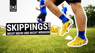 Skippings Variation – Auf die Feinheiten achten für ein gutes Training der LaufBasics [upl. by Dominica345]