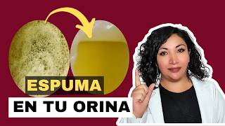 ELIMINA la espuma de tu orina porque tu orina tiene espuma 😨 [upl. by Ineslta917]