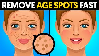 The quickest way to remove age spots [upl. by Rosane]