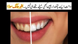 Teeth Whitening Treatment at Home [upl. by Volkan]