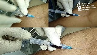 Safe and effective blood draw technique How to take blood phlebotomy [upl. by Alyahsal]