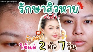 พิสูจน์ ใช้ EUCERIN ตัวใหม่ Gel to FoamSOS SERUM รักษาสิวหายใน 7 วันได้จริงมั้ย  MAYNESSA [upl. by Dimitry]