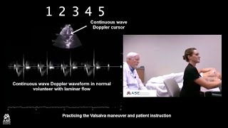 How to Perform Valsalva Maneuver in Patients with HCM [upl. by Hedi]