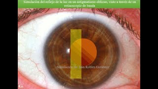 Práctica retinoscopía Simulación de un astigmatismo oblicuo [upl. by Esidnak]