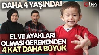 4 Yaşındaki Çocuğun Yaşına Oranla El ve Ayakları Orantısız Büyüyor [upl. by Aekin]