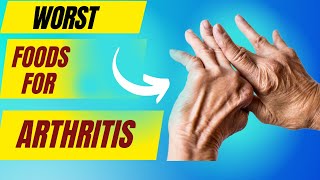 Foods to avoid with arthritis Anti inflammatory diet for arthritis  Arthritis causes food [upl. by Hilton]