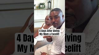 I Gave My Mom a Facelift 🥹 Day 4 Update plasticsurgeon [upl. by Aicined]