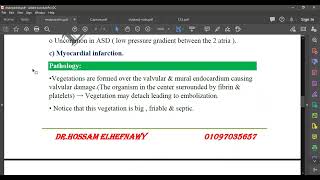 L25 Endocarditis [upl. by Anerok]