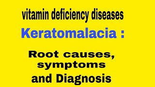 Keratomalacia Vitamin deficiency diseases [upl. by Encrata]