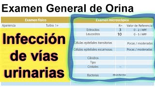 Examen general de orina Interpretación [upl. by Yenohtna]