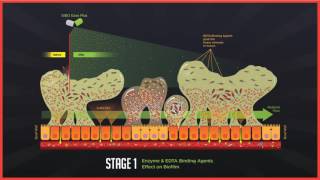 How to Treat a Leaky Gut and Bacterial Over Growths SIBO [upl. by Di]