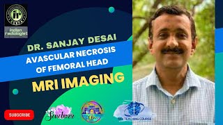 AVASCULAR NECROSIS OF FEMORAL HEAD  DR SANJAY DESAI  mriteachingcourse [upl. by Aiek737]