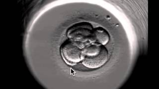 ivf embryo developing over 5 days by fertility Dr Raewyn Teirney [upl. by Tesler]