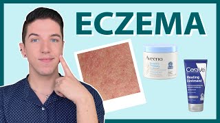 Eczema How to Treat amp Get Rid of It [upl. by Harcourt]