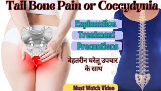 Tail Bone Pain or Coccydynia  Explanation amp Treatment  Best Home Remedies  Dr Rajesh Sharma PT [upl. by Ahsinotna]