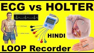 Rx Heart epi 11 h  How to Monitor Heart  ECG vs HOLTER vs LOOP recorder HINDI DrEducation [upl. by Reid]