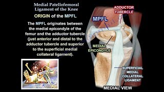 Medial Patellofemoral Ligament Of The Knee Anatomy Everything You Need To Know  Dr Nabil Ebraheim [upl. by Amaryl]