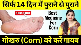 गोखरू को हमेशा के लिये ठीक कैसे करें  Foot Corn Homeopathic Treatment  Corn ka ilaj  Callosities [upl. by Parthinia]