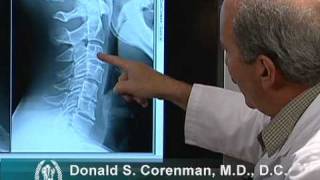 How to Read Xrays of the Cervical Spine Neck  Colorado Spine Expert [upl. by Leissam]