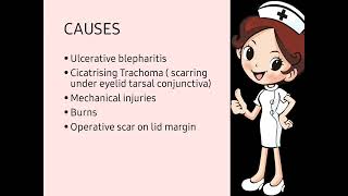 TRICHIASIS  Misdirected Eyelashes [upl. by Fransen]