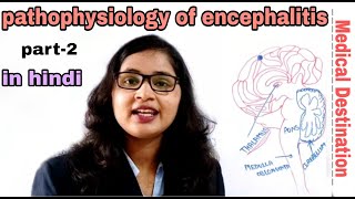 Encephalitis part2  pathophysiology  symptoms  treatment in hindi  medical Destination [upl. by Suellen403]