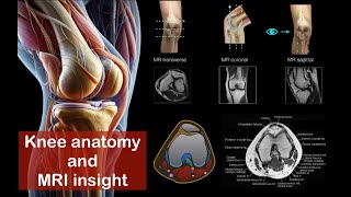 Knee Sectional Anatomy with MRI Insight in Axial Coronal Sagittal Plains [upl. by Luamaj]