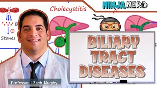 Biliary Tract Diseases  Clinical Medicine [upl. by Gagne169]