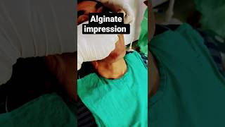 Upper Dental impression dental Alginate impression [upl. by Lutero]