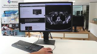 EIZO RadiForce MX315W  Ideal for viewing patient charts with MRI and CT medical images [upl. by Nallek]