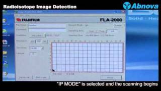 Radioisotope Image Detection [upl. by Ysdnil79]