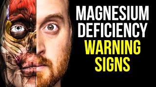 10 Signs of Magnesium Deficiency to Never Ignore [upl. by Audly982]