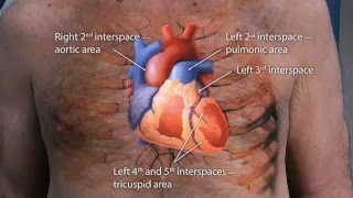 Macleods Physical Examination Of The Cardiovascular System OSCE Guide 2016 [upl. by Lirret]