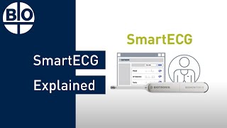 SmartECG Explained How SmartECG Can Help Improve Arrhythmia Detection [upl. by Haldeman]