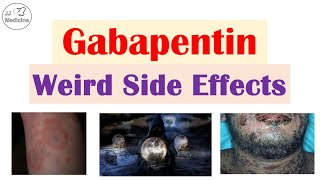 Gabapentin Weird Side Effects Skin Psychological Eyes [upl. by Althea]