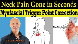 Neck Pain Gone in Seconds SelfHelp Myofascial Trigger Point Correction  Dr Alan Mandell DC [upl. by Avehs]