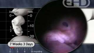 7 Weeks Pregnant  Hiccups amp Startle Response [upl. by Gasper]