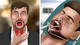 ASMR Animation Remove fish bones stuck in MrBeasts throat [upl. by Wolsky]