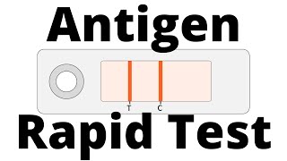 How SARSCoV2 Antigen Rapid Tests work Covid19 Testing [upl. by Marigolde]