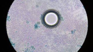 CO2 Bubble From Yeast saccharomyces carbondioxide microscopy [upl. by Delbert546]